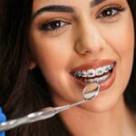 Why Removing Braces at the Right Moment Matters for Long-Term Dental Stability