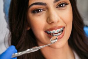 Why Removing Braces at the Right Moment Matters for Long-Term Dental Stability